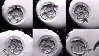 IVF PROCESS STEP BY STEP In Vitro Fertilisation Embryo cultivation [upl. by Ettena]