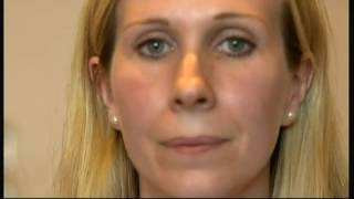 Face Blindness  Prosopagnosia  BBC  29th June 2016 [upl. by Kelli528]