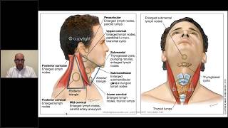 Benign Breast Conditions  USMLE COMLEX NCLEX [upl. by Rebmyt]