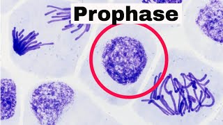 Prophase [upl. by Anawyt394]