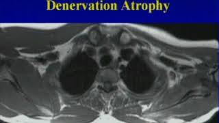 Lumbar Plexus  Structure and Branches  Anatomy Tutorial [upl. by Leno]