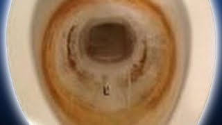 How To Get Rid of Toilet Stains Pt 2  How to Use Muriatic Acid to Clean Toilet Bowl HD [upl. by Haimorej258]