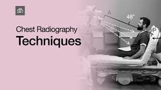 Chest Radiography Techniques [upl. by Scibert52]