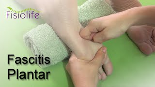 🦶Fascitis Plantar Diagnóstico tratamiento y consejos  FISIOLIFE 😁 [upl. by Anilet]