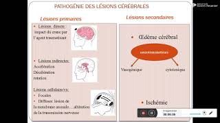 Neuroanatomie Le Liquide CéphaloRachidien LCR [upl. by Lisabeth108]