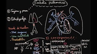 Embolie pulmonaire  Pathophysiologie  Partie 1  Docteur Synapse [upl. by Jerusalem]