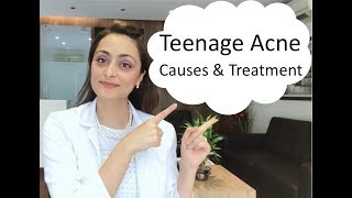 Teenage Acne causes amp treatment [upl. by Higgins982]